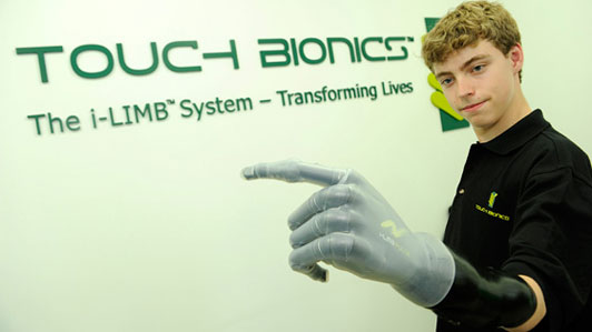 Mercedes F1 Team Builds 14-Year-Old Fan A Bionic Hand